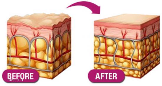 SER ANTI-AGING CU ACID HIALURONIC SI ULEI DE CATINA CU EFECT DE LIFTING FACIAL DR. TEMT